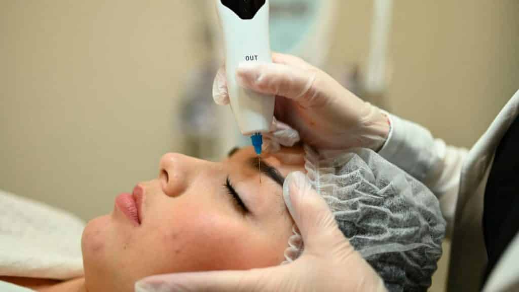 Fibroblast Beneficios