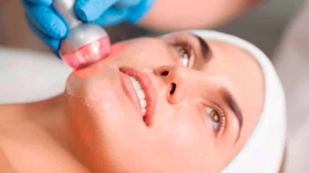 Beneficios de la Radiofrecuencia Facial