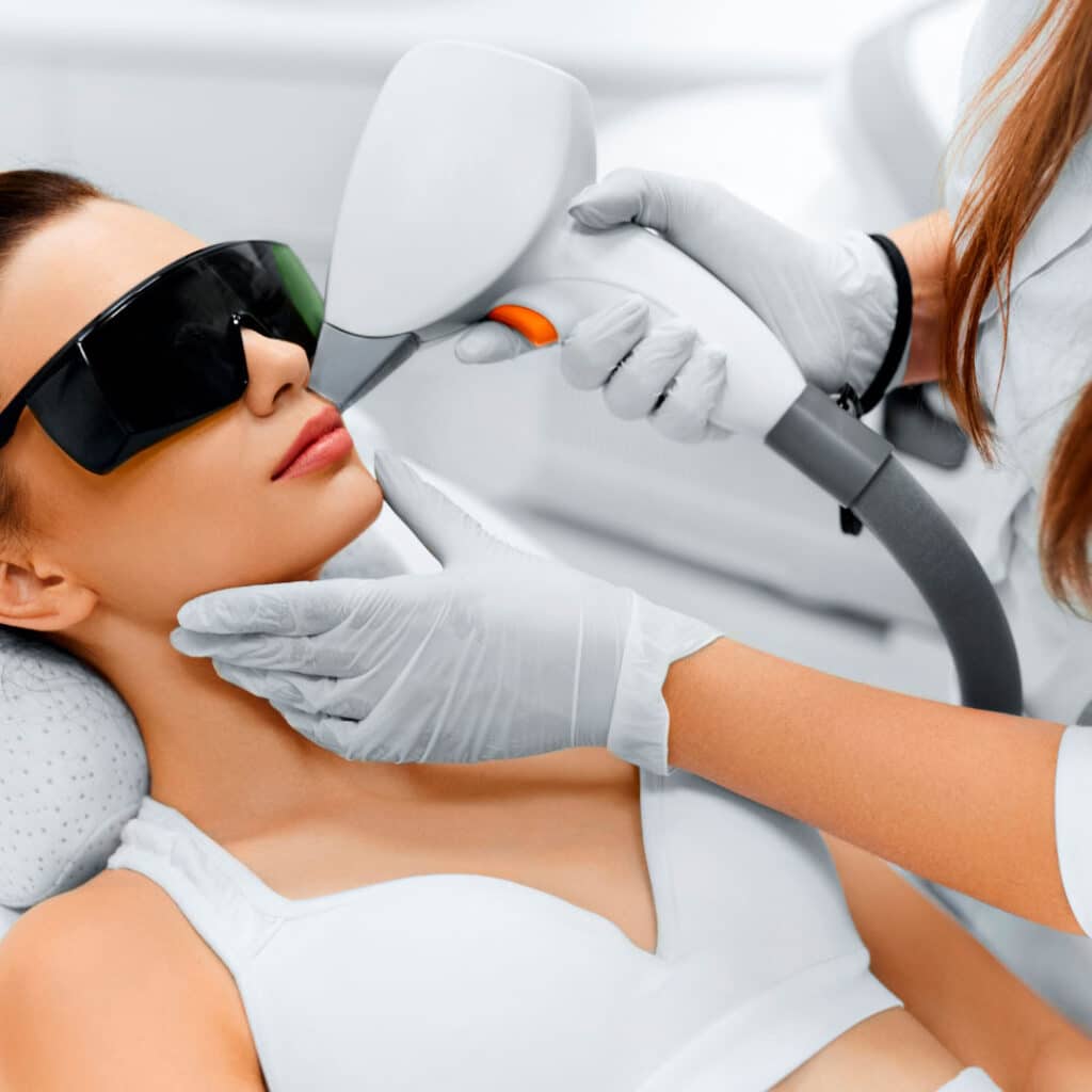 Fotodepilación láser