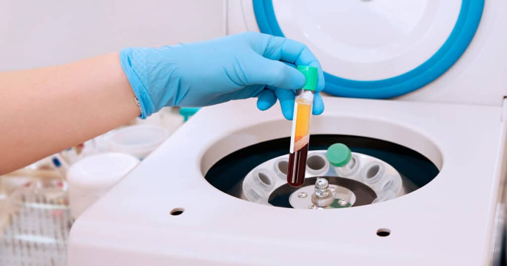 Plasma-Rigo-en-plaquetas-portada