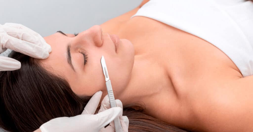 Dermaplaning